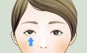 소아시력과 사시